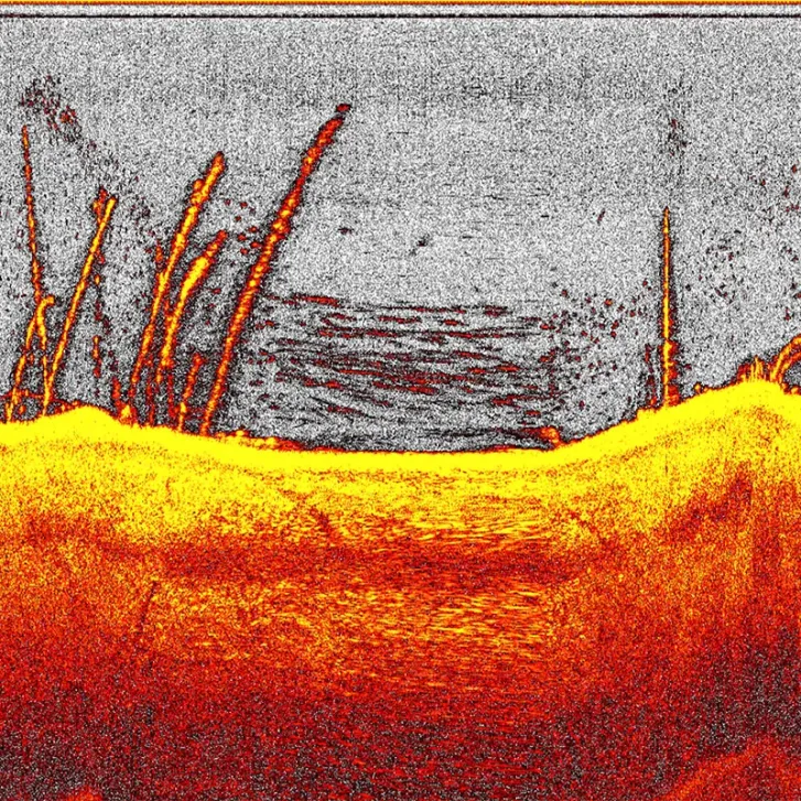 Deeper Downscan-Modul für QUEST
